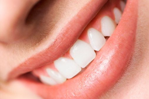 Clínica Dental Milagros Vizcay Almeida sonrisa de mujer