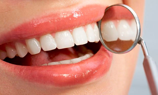 Clínica Dental Milagros Vizcay Almeida dentadura de mujer